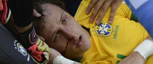David Luiz fullf�rte cupkamp etter stygg hodesmell