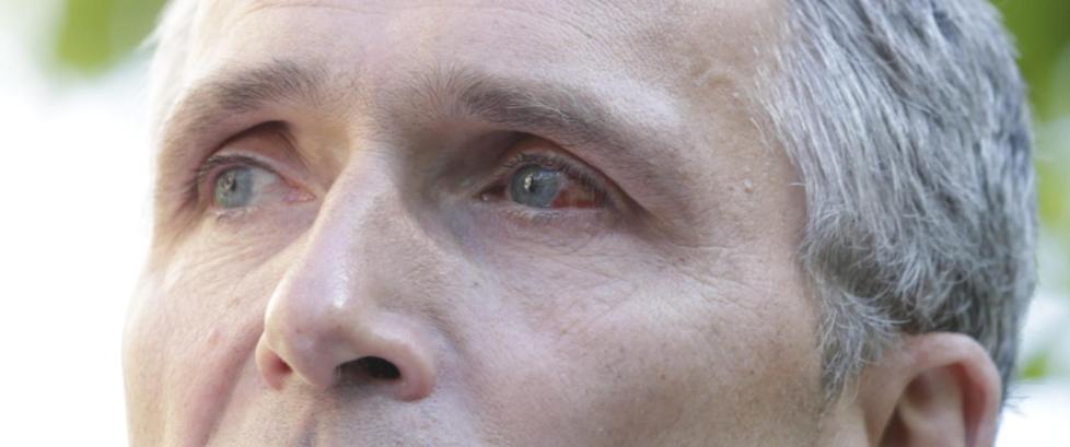 Stoltenberg møtte pressen for første gang etter operasjonen