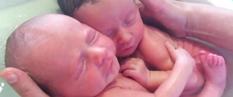 13 millioner har sett tvillingene gjenoppleve livet i mors mage