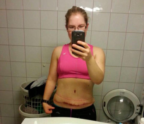øktxlyst kvinner smerter øverst i magen øktxlyst kvinner smerter øverst i magen