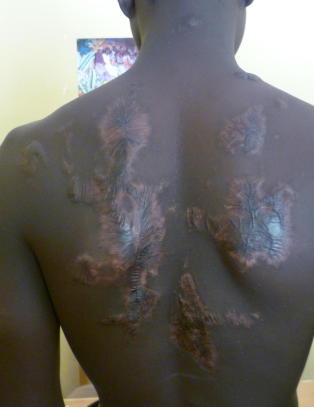 - Det nigerianske militæret torturerer sivile og barn