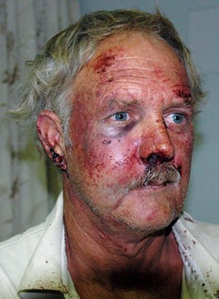BANKET OPP AV MUGABES KRIGSVETERANER: William Rogers skal ha blitt overfalt hjemme p� g�rden sin av Mugabes gamle kampfeller etter f�rste valgomgang i v�r. Hvite farmere i Zimbabwe har v�rt rettsl�se helt siden Mugabe i 2000 sluttet � kompensere for annekterte g�rder tilh�rende hvite. Foto: EPA/SOKWANELE/SCANPIX