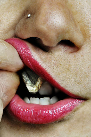 POSE: Snus blir stadig mer vanlig blant jentene. Foto: Lars Myhren Holand