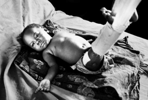 BLE SKUTT AV MILITSEN: Den lille babyen ble hardt skadd da moren som bar  barnet p� ryggen ble skutt og drept. Faren Ngarambe forlater ikke sykehus-sengen. Bilde: Fra filmen Condition: Critical/Leger Uten Grenser/C�dric Gerbehaye