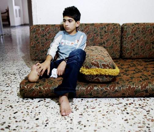 FOTEN KL�R: N�r Hussein Ali Zoreik (13) ikke har p� seg fotprotesen, sitter han hele tiden og sm�kl�r p� foten sin. - Det f�les som at det er mange maur inni foten hele tida, synes Hussein. Foto: Torbj�rn Gr�nning