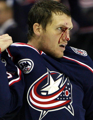 Tollefsen kolliderte med elg