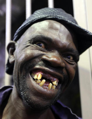 Raser mot «Mister Ugly»-vinner: - Jeg er naturlig stygg. Han er bare stygg når han åpner munnen