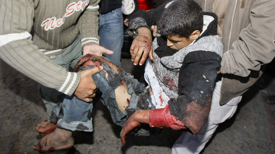 FLERE SIVILE DREPT: En skadet palestinsk ungdom b�res til sykehus i Gaza by s�ndag. D�dstallene siden den israelske bakkeinvasjonen er uklare, men det meldes om mellom 25-35 drepte. Flere av dem skal v�re kvinner og barn. Foto: AFP/SCANPIX