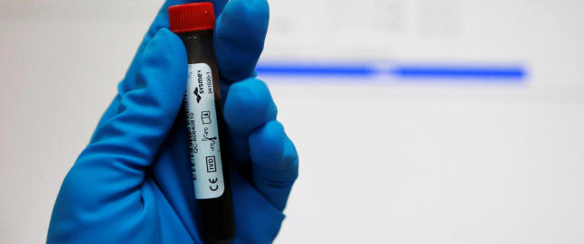 Nå vil Russland skremme dopere med strenge straffer