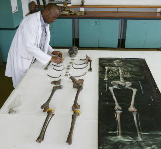 TURKANA-GUTTEN: For rundt 1.6 million �r siden mener forskerne at livet for menneskets forfedre begynte � endre seg dramatisk. Det ber�mte skjelettet til Turkana-gutten som ble funnet i Kenya i 1984, viste en langbenet homo ergaster som antakelig beveget seg over lange distanser. Det at de var mer aktive f�rte til problemer med overoppheting. V�re forfedre fikk dermed mindre kroppsh�r og flere svettekjertler. Problemet som da oppsto var beskyttelse fra de skadelige UV-str�lene. Foto: AP/Sayyid Azim