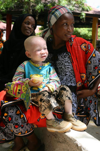 UKJENT SYN I KENYA: En kvinne i Tanzania med sitt lyshudede barn. Barnet er albino, manglende pigment i huden gj�r den lys. Foto: REUTERS/Stringer