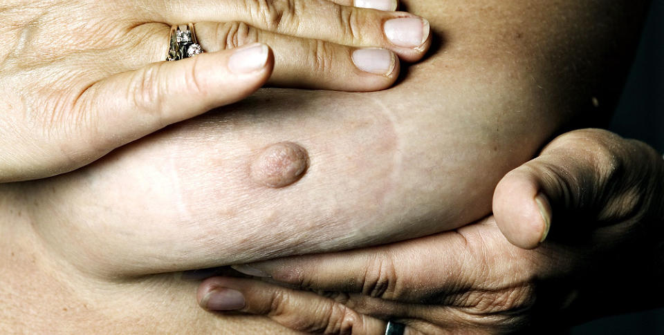 GODE PROGNOSER: Resultater av brystkreftbehandlingen ved sykehuset i Stavanger viste at bare 1,36 prosent av kvinnene fikk tilbakefall. Foto: NINA HANSEN