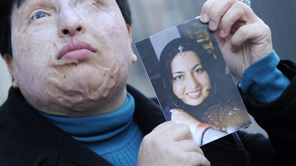 SLIK S� HUN UT F�R: Ameneh Bahrami har f�tt store skader og er blind etter syreangrepet i 2004. Foto: AFP Photo/LLUIS GENE/Scanpix