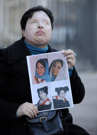 VILLE IKKE GIFTE SEG: Ameneh Bahrami vil at mannen skal f� sin straff, slik at ikke flere kvinner opplever det samme som henne. Foto: AFP Photo/LLUIS GENE/Scanpix