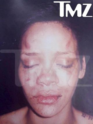 KRAFTIG FORSL�TT: Dette bildet av en forsl�tt Rihanna skapte reaksjoner og overskrifter verden over. Rettssaken p�g�r n�. Foto: SCANPIX