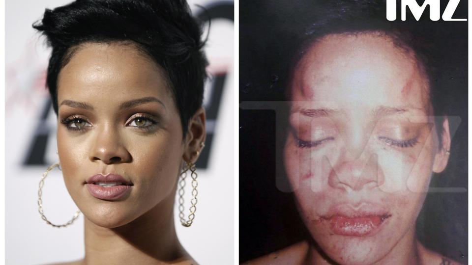 SKAMSL�TT: Et bilde av en skamsl�tt Rihanna dukket opp p� nettet rett etter at angrepet skal ha funnet sted. Foto: SCANPIX