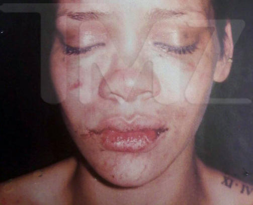 BANKET OPP AV KJ�RESTEN CHRIS BROWN:  Slik s� Rihanna ut etter mishandlingen i bilen.  Foto: SCANPIX/AP Photo/TMZ
