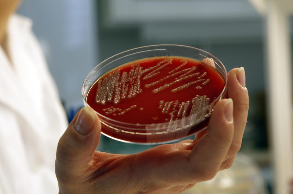 JAKTER P� SMITTEKILDEN: Folkehelseinstituttet har fortsatt ikke funnet smittekilden til E.coli-utbruddet. Foto: Bj�rn Sigurds�n / SCANPIX .