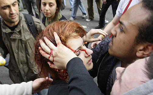 BLODIG: Det skal ha kommet til flere blodige sammenst�t mellom demonstranter og politiet i l�pet av ettermiddagen. Foto: STEFAN WERMUTH / REUTERS / SCANPIX