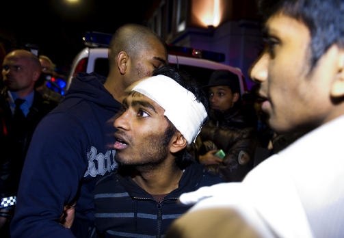 SKADD: Gowtham (18), fikk et kutt i hodet under de verste tumultene og fikk bandasje  av en lege p� stedet.  Foto: H�KON EIKESDAL