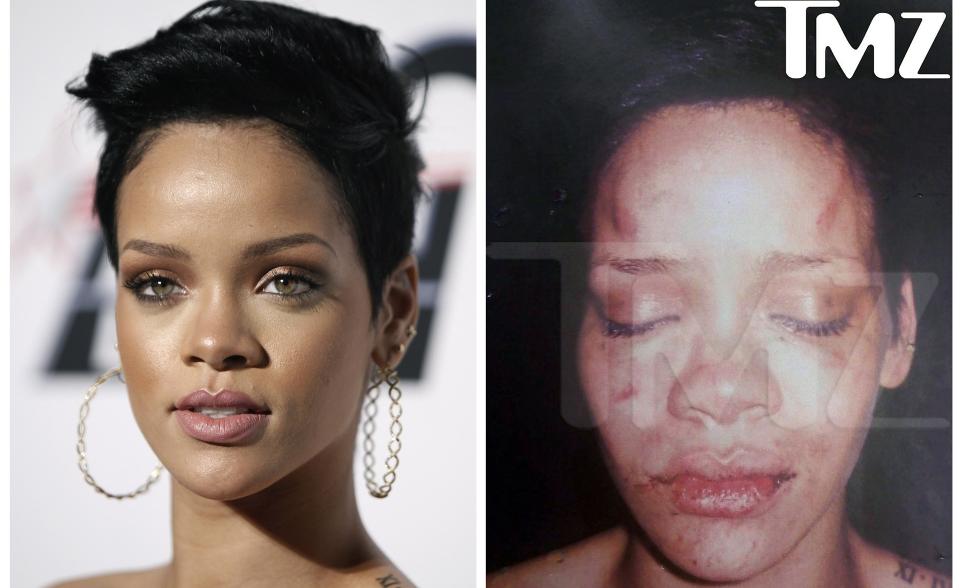 STYGT MISHANDLET: Artist Rihanna ble sl�tt av ekskj�resten Chris Brown. N� forteller hun om angrepet og tida etter. Foto: AP Photo/Matt Sayles/TMZ/Scanpix
