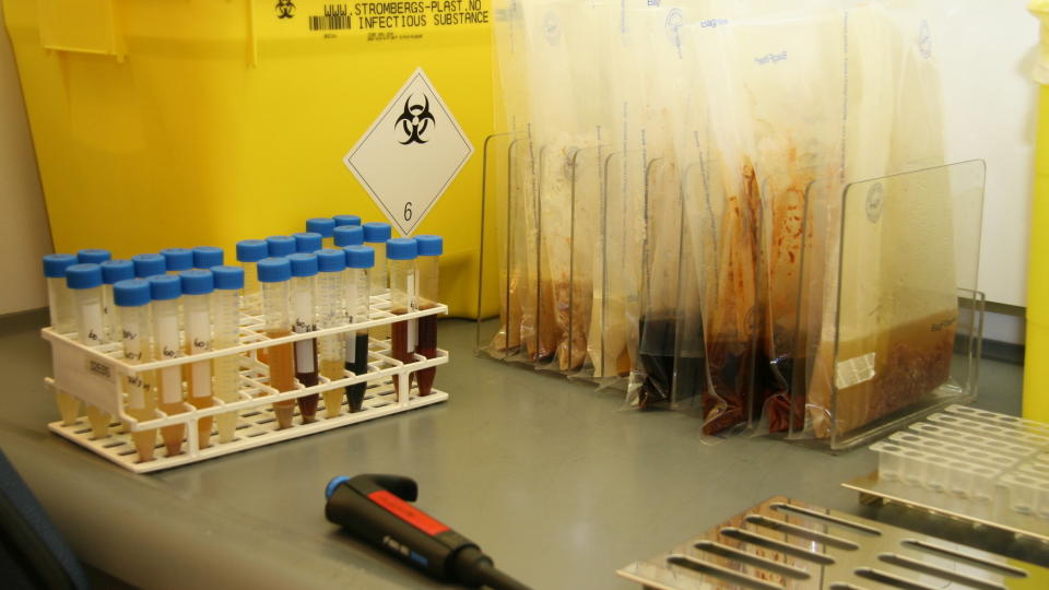 MISTENKER FLERE SMITTETILFELLER: Ni barn kan v�re knyttet til det nasjonale E. coliutbruddet. De siste dagene har det v�rt tre tilfeller av nyresykdommen HUS, som knyttes opp mot mulig smitte av en farlig variant av E. coli. Foto: HANNE MARI JORDSMYR/VETERIN�RINSTITUTTET
