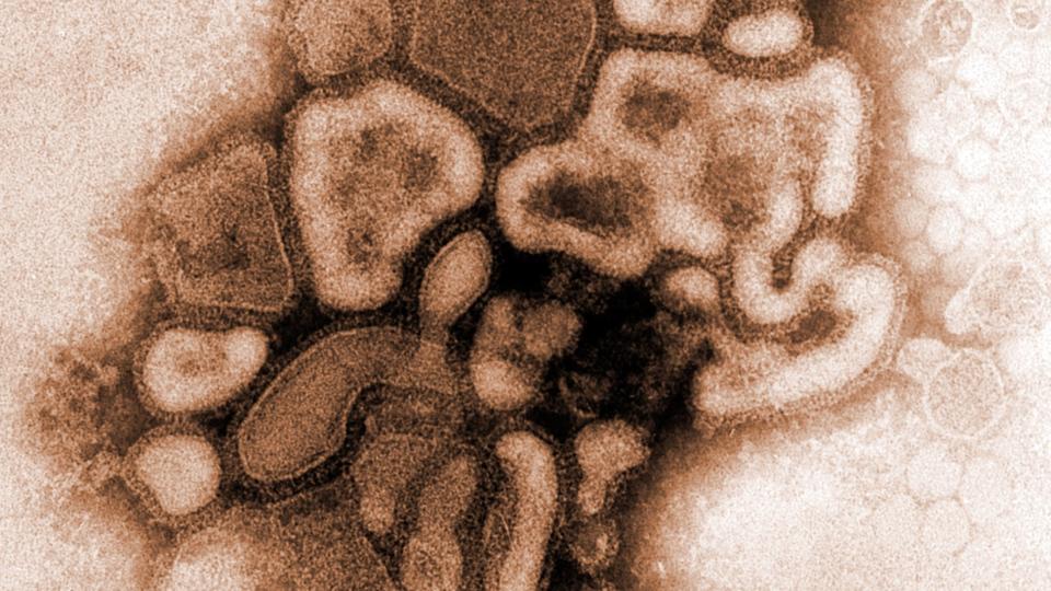 EPIDEMI: Influensa A(H1N1)-undervarianten kjent som svineinfluensa. Brasil og Argentina har p�vist sine f�rste tilfeller.  REUTERS/Dr. Erskine Palmer and R.E. Bates/Centers for Disease Control