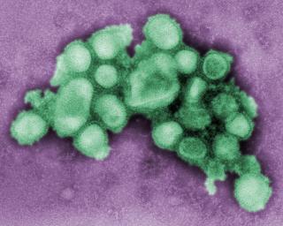 SYNDEREN: Svineinfluensaen, for�rsaket av et influensa A-virus, truer med en global pandemi. Foto:  AP Photo/Center for Disease Control and Prevention, C. S. Goldsmith and A. Balish/SCANPIX