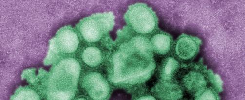VIRUSET... av typen H1N1. Stadig flere blir smittet av svineinfluensa, og WHO mener det bare et tidssp�rsm�l f�r vi st�r overfor en pandemi. Foto: Scanpix/AP Photo/Center for Disease Control and Prevention, C. S. Goldsmith and A. Balish
