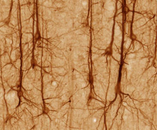 OMFATTENDE NETTVERK: Nerveceller er ikke som alle andre, de har et omfattende nettverk. B�de fysikere, informatikere og matematikere bruker matematiske og fysiske modeller til � forklare prosesser i biologiske systemer som blant annet hjernen. Foto: WIKIMEDIA