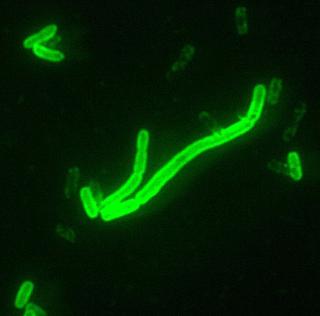 SVAK FOR ANTIBIOTIKA: Det finnes ogs� en vaksine mot pestbasillen, som kan angripe lunger eller lymfer. Foto: CDC, Det amerikanske folkehelseinstituttet/WIKIMEDIA