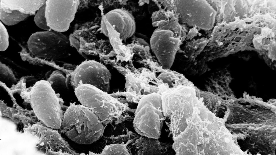 YERSINA PESTIS: Pestbakterien som for�rsaket svartedauden lever videre i beste velg�ende. Den dreper flere tusen mennesker i �ret, men er en st�rre trussel mot dyr, s�rlig gnagere.  Foto: WIKIMEDIA
