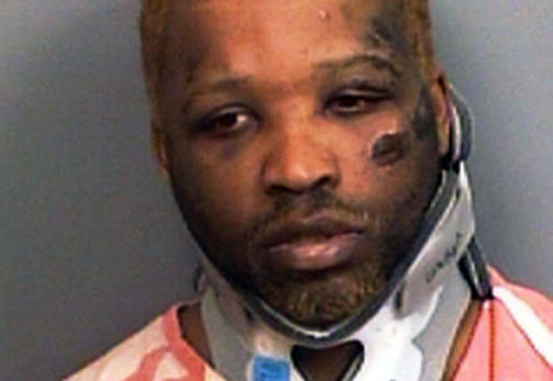 HAVNET P� SYKEHUS: Anthony Warren ble sl�tt bevisstl�s idet han kj�rte i gr�fta. Etterp� ble han innlagt p� sykehus og skal selv ikke ha husket at han ble banket opp av politimennene. Foto: AP Photo/Jefferson County Sheriff's Office/SCANPIX