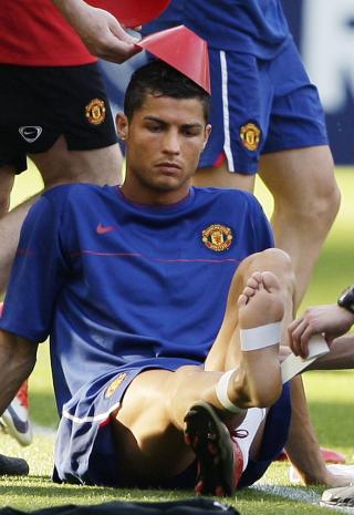 CONEHEAD: En sk�yer i Uniteds st�tteapparat plasserer en plastkjegle p� hodet til Ronaldo mens han f�r ankelen tapet opp i forbindelse med g�rsdagens trening.  Foto: Darren Staples, Reuters/Scanpix