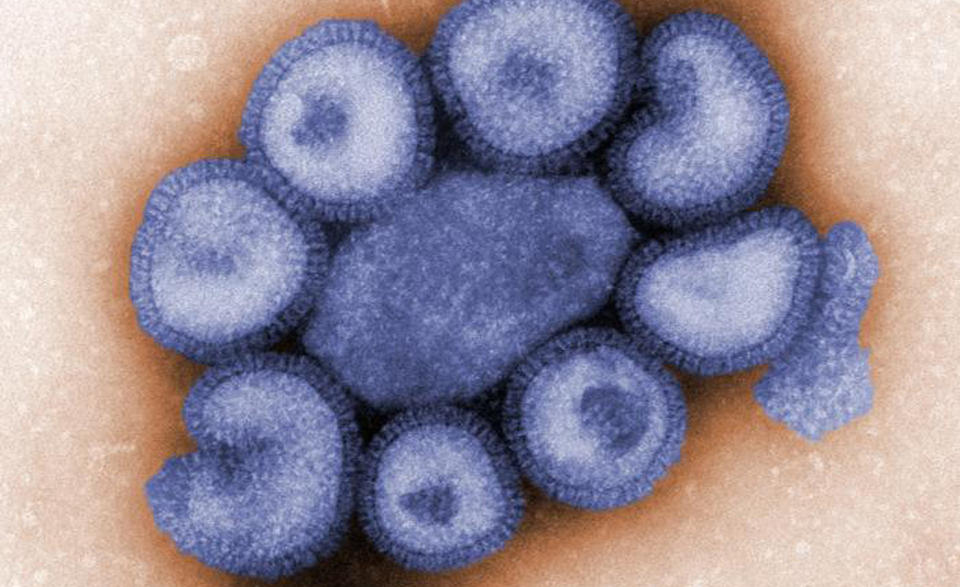  FEM NYE TILFELLER:  De siste fire dagene er det registrert fem nye tilfeller av svineinfluensa i Norge. Foto: AP Photo/Center for Disease Control and Prevention, C. S. Goldsmith and A. Balish