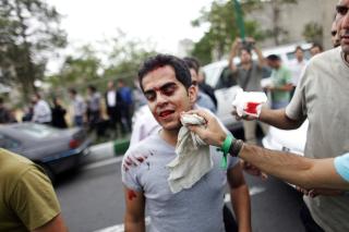 SKADD: En skadd tilhenger av Mousavi f�r t�rket av seg blodet. Foto: REUTERS/Damir Sagolj/SCANPIX