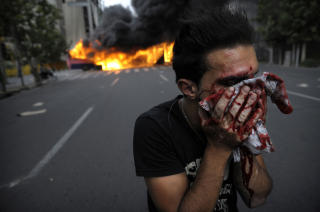 TEHERAN BRENNER: En demonstrant tørker blod etter møtet med opprørspolitiet. Foto: Scanpix/ AFP PHOTO/OLIVIER LABAN-MATTEI TEHERAN BRENNER: En demonstrant tørker blod etter møtet med opprørspolitiet. Foto: Scanpix/ AFP PHOTO/OLIVIER LABAN-MATTEI