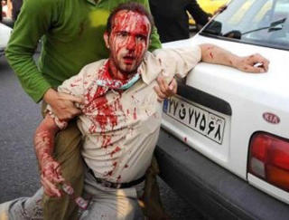 MILITS ANGRIPER SIVILE: Under demonstrasjonene har milits angrepet sivile demonstranter.  Foto: REUTERS/Your View