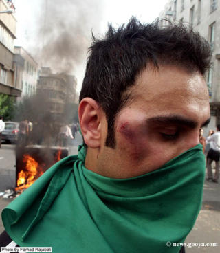 VOLDELIG: En iransk demonstrant med en tydelig bl�veis p� kinnet under l�rdagens demonstrasjon. Foto: SCANPIX REUTERS/Farhad Rajabali/news.gooya.com