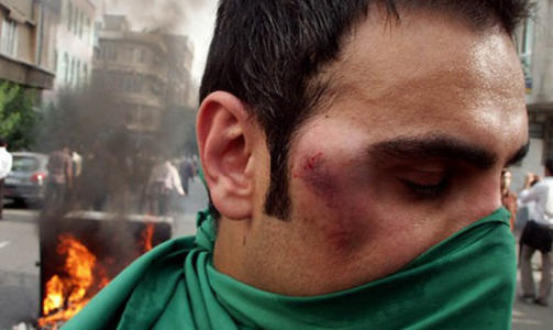 GATESLAG: En ung mann med tydlige skader under gateslagsm�lene i Tehran.  Reuters and other foreign media are subject to Iranian restrictions on leaving the office to report, film or take pictures in Tehran Foto: Farhad Rajabali/news.gooya.com/REUTERS