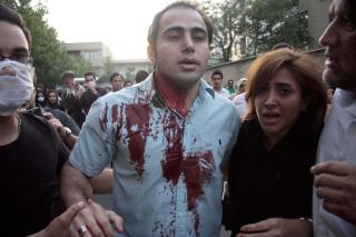 DEMONSTRASJONENE FORTSETTER: Til tross for at media holdes borte fra gatene i Iran kommer bildene gjennom. Dette er tatt p� s�ndag, og viser en bl�dende demonstrant i Teheran. Foto: REUTERS/Demotix