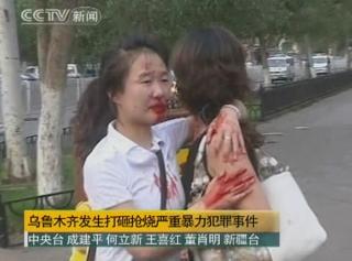 DE OFFISIELLE: Dette er bildene Kina viser omverdenen. Hankinesere som bl�r etter � ha blitt angrepet av uigurer. Foto: REUTERS/CCTV/SCANPIX