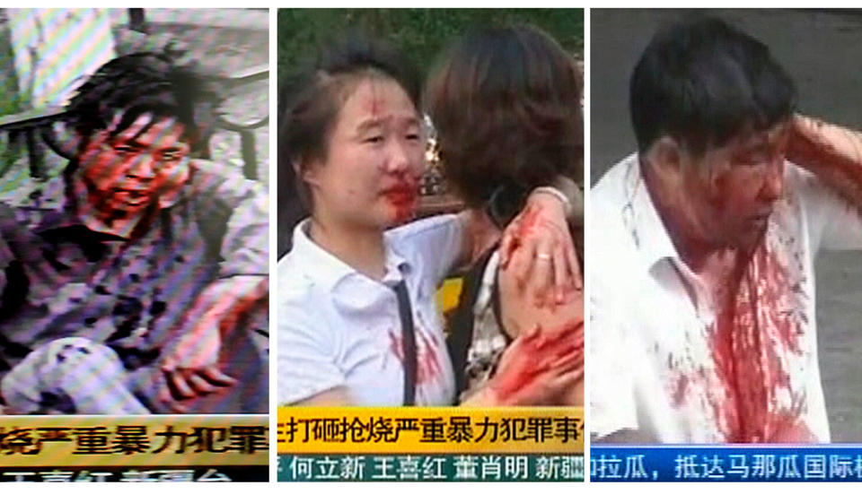 BLODIG: Dette er bildene som har g�tt ut til bildebyr�ene og p� kinesisk fjernsyn. Bilder av skadde hankinesere under s�ndagens sammenst�t i Xinjiang. Foto: AFP/REUTERS/CCTV/SCANPIX