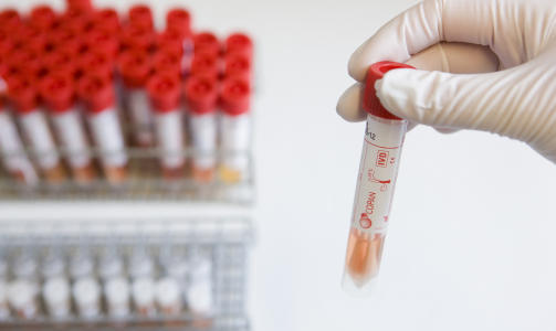 SMITTETESTER: Mikrobiologisk laboratorium ved Ullev�l Sykehus i Oslo f�r inn pr�ver og tester etter virus A (H1N1), bedre kjent som svineinfluensa. Foto: Berit Roald / SCANPIX