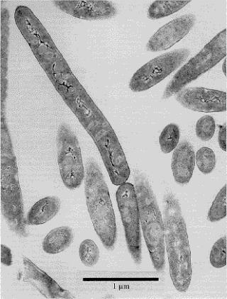 HELVETESBAKTERIEN: En rekke organismer, s�kalte ekstremofiler, lever under utenkelige forhold p� jorda. Bakterien Bacillus infernus lever dypt under overflata, og beviser at liv kan trives under forferdelige forhold. Foto: U.S. Dept. of Energy/Subsurface Microbial Culture Collection