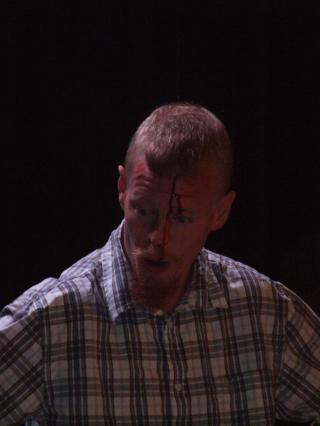 FORLOT DEBATTEN: �yvind Heian forlot debatten med et blodig kutt i panna. Foto: CHRISTIAN H�YB�