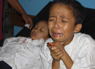 SKADET: En gutt skadet under jordskjelvet venter p� behandling ved et sykehus Tasikmalaya p� �ya Java i Indonesia. Foto: AP