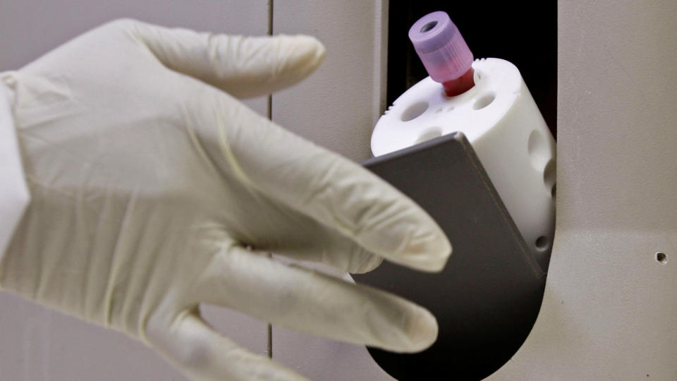 GLAD FOR VAKSINENYHET: HivNorge mener det er sv�rt viktig at det n� er kommet positive resultater i en studie av HIV-vaksine. P� dette bildet testes blod for HIV-smitte. Foto: AP/SCANPIX