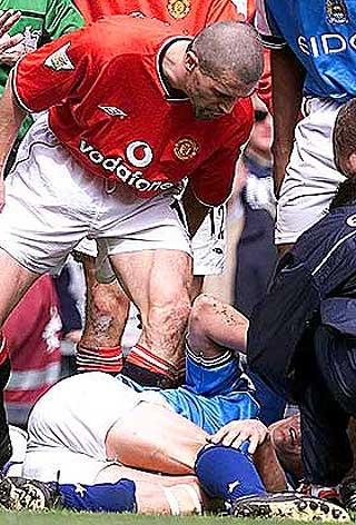 MED OVERLEGG: Alf Inge H�land kom aldri tilbake p� samme niv� etter taklinga fra Roy Keane. Iren fortalte i biografien sin at det hele var n�ye planlagt, noe han ogs� ga nordmannen beskjed om umiddelbart etter taklinga. Foto: SCANPIX