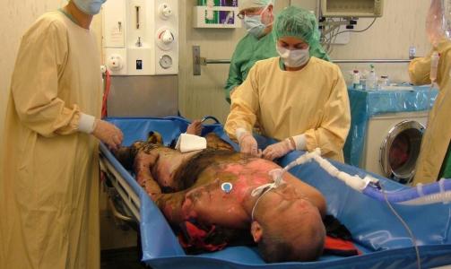 INTENSIVBEHANDLING: Rune ble behandlet p� Haukeland universitetssykehus i 50 d�gn. Foto: PRIVAT